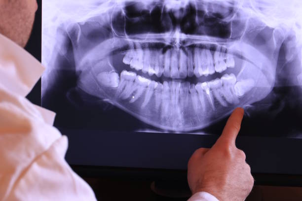 Best Weekend Emergency Dentist in Wellsville, OH