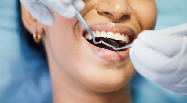Best Urgent Care for Lost Fillings or Crowns in Wellsville, OH